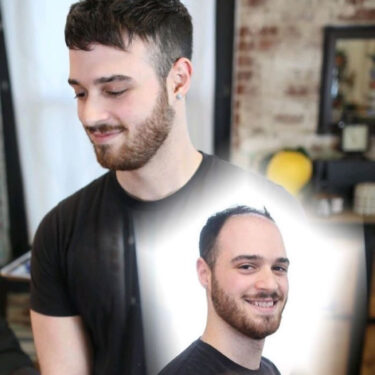 Hair Replacement Systems Non-Surgical Hair Replacement at Darc'r Hair Salon in Rotherham