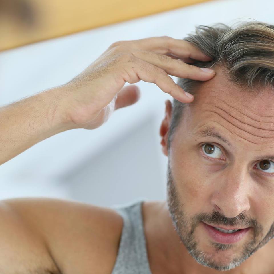 MAN WITH HAIR LOSS Hairdressers in Rotherham Offering Hair Replacement Systems